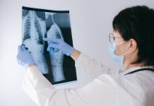 Zadýchavate sa? Vaše pľúca volajú o pomoc! Chronická obštrukčná choroba pľúc