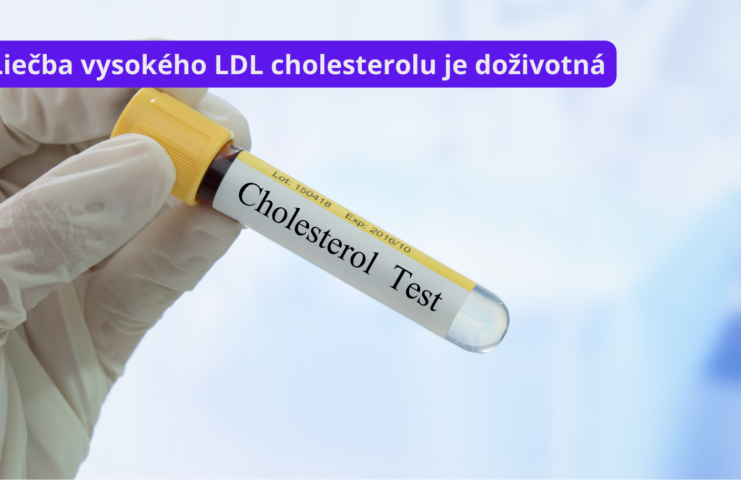 Čo vám hrozí, ak nebudete riešiť vysokú hladinu LDL cholesterolu? Stačia na zníženie LDL cholesterolu voľnopredajné lieky?