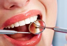 Ako si udržať zdravé zuby celý život? S pomocou dentálnej hygieny Dentálna hygiena je odborné čistenie chrupu, ktoré zahŕňa odstránenie zubného kameňa, povlaku, pigmentov a kontrolu ústneho zdravia.