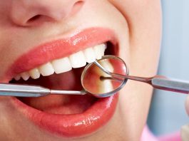 Dentálna hygiena je odborné čistenie chrupu, ktoré zahŕňa odstránenie zubného kameňa, povlaku, pigmentov a kontrolu ústneho zdravia.