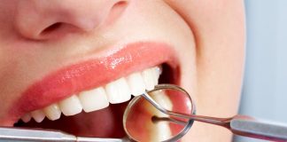 Dentálna hygiena je odborné čistenie chrupu, ktoré zahŕňa odstránenie zubného kameňa, povlaku, pigmentov a kontrolu ústneho zdravia.