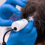 Denne stratíme približne 50 až 100 vlasov. Ide o prirodzený cyklus rastu, odpočinku a vypadnutia vlasu. Kedy nastáva problém padania vlasov?