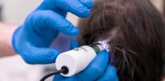 Denne stratíme približne 50 až 100 vlasov. Ide o prirodzený cyklus rastu, odpočinku a vypadnutia vlasu. Kedy nastáva problém padania vlasov?